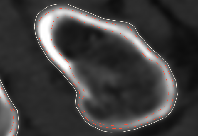 cortex_example_2.png