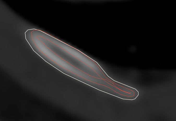 cortex_exampl_3.png